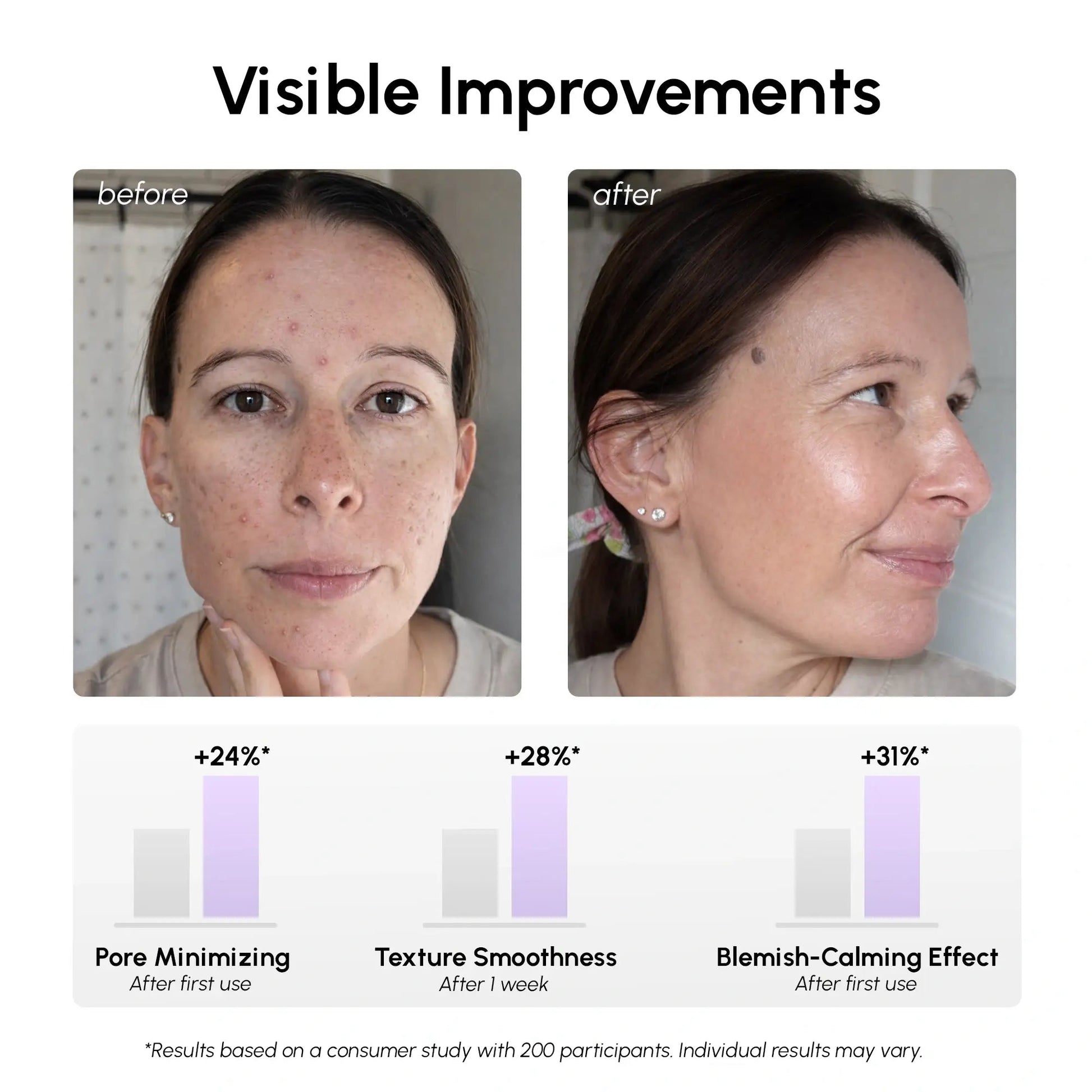 12% Niacinamide Smooth & Glow Pads - Luvora
