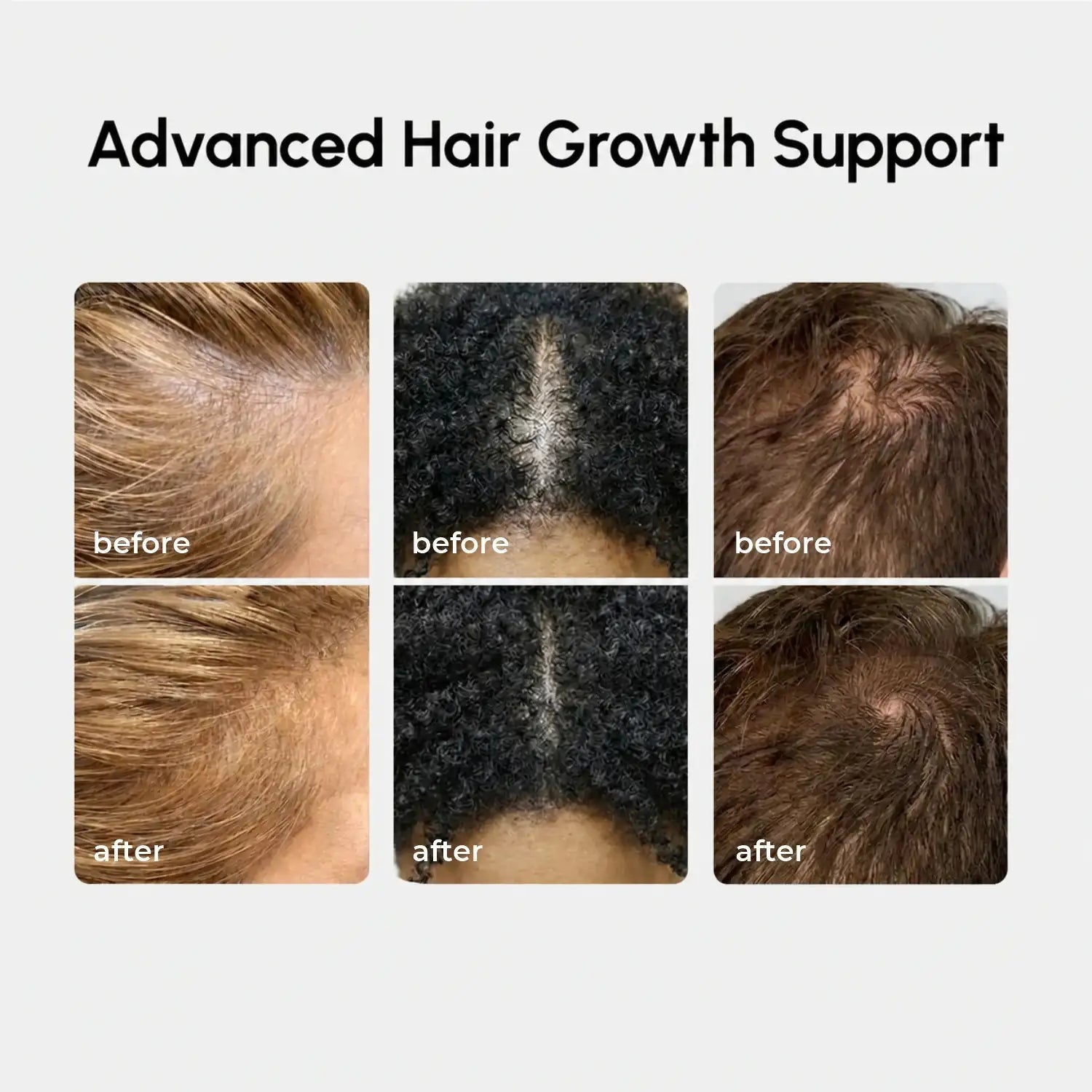4-in-1 Hair Growth Spray - Luvora
