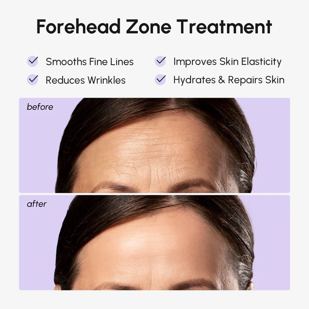 Anti-Wrinkle Forehead Patches - Luvora