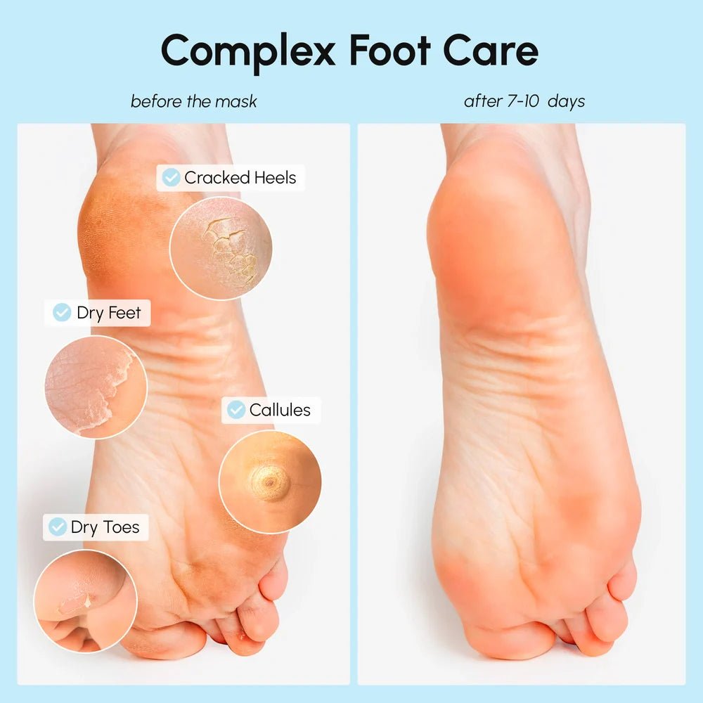 Exfoliating & Hydrating Foot Mask - Luvora