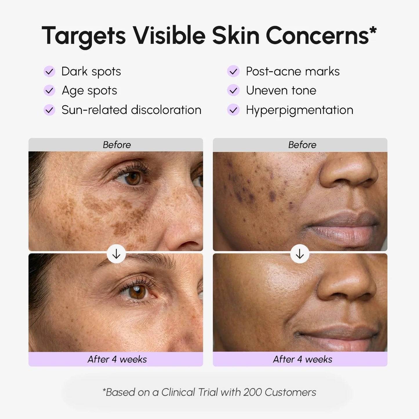 Face & Body Serum for Dark Spots - Luvora