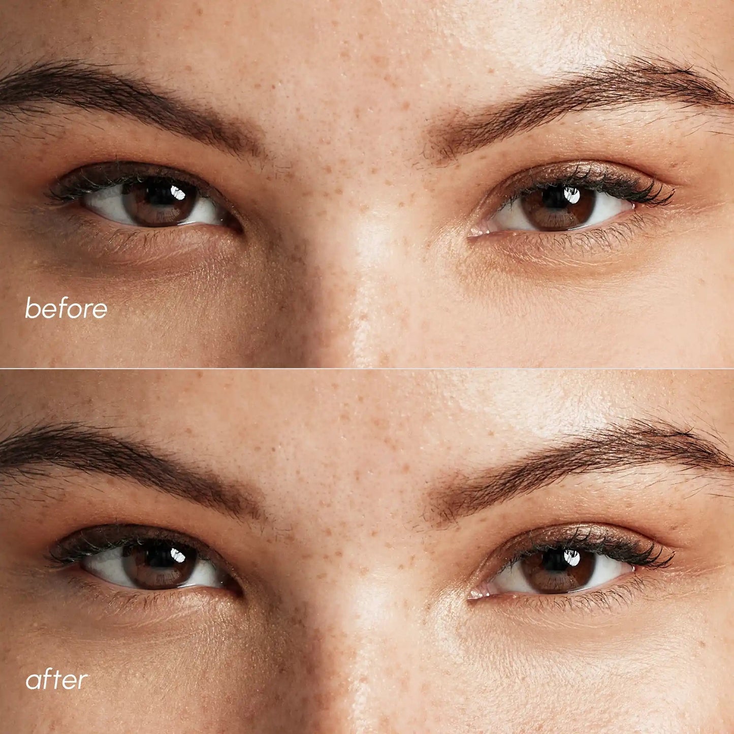 Pink Eye Patches for Puffy Eyes - Luvora