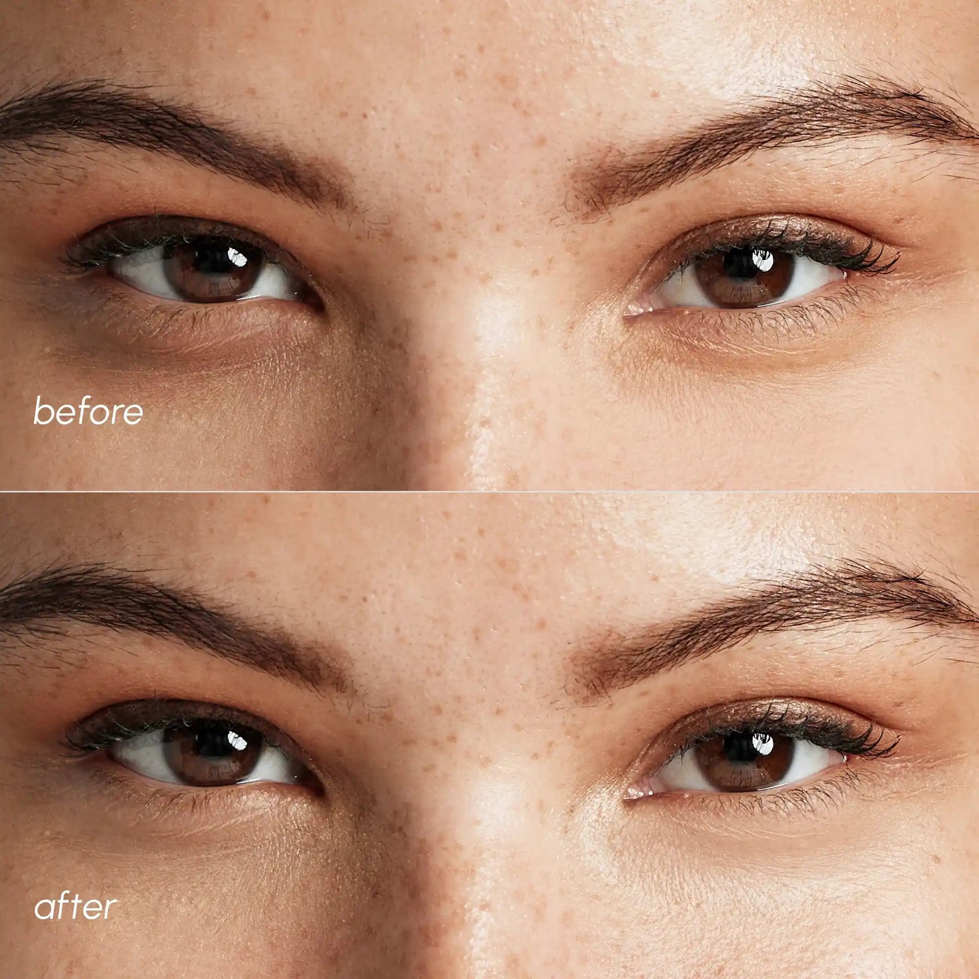 Pink Eye Patches for Puffy Eyes - Luvora