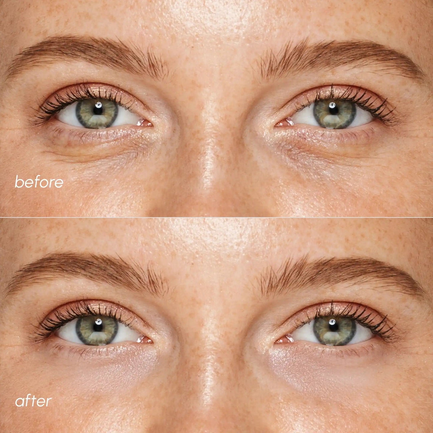 Pink Eye Patches for Puffy Eyes - Luvora