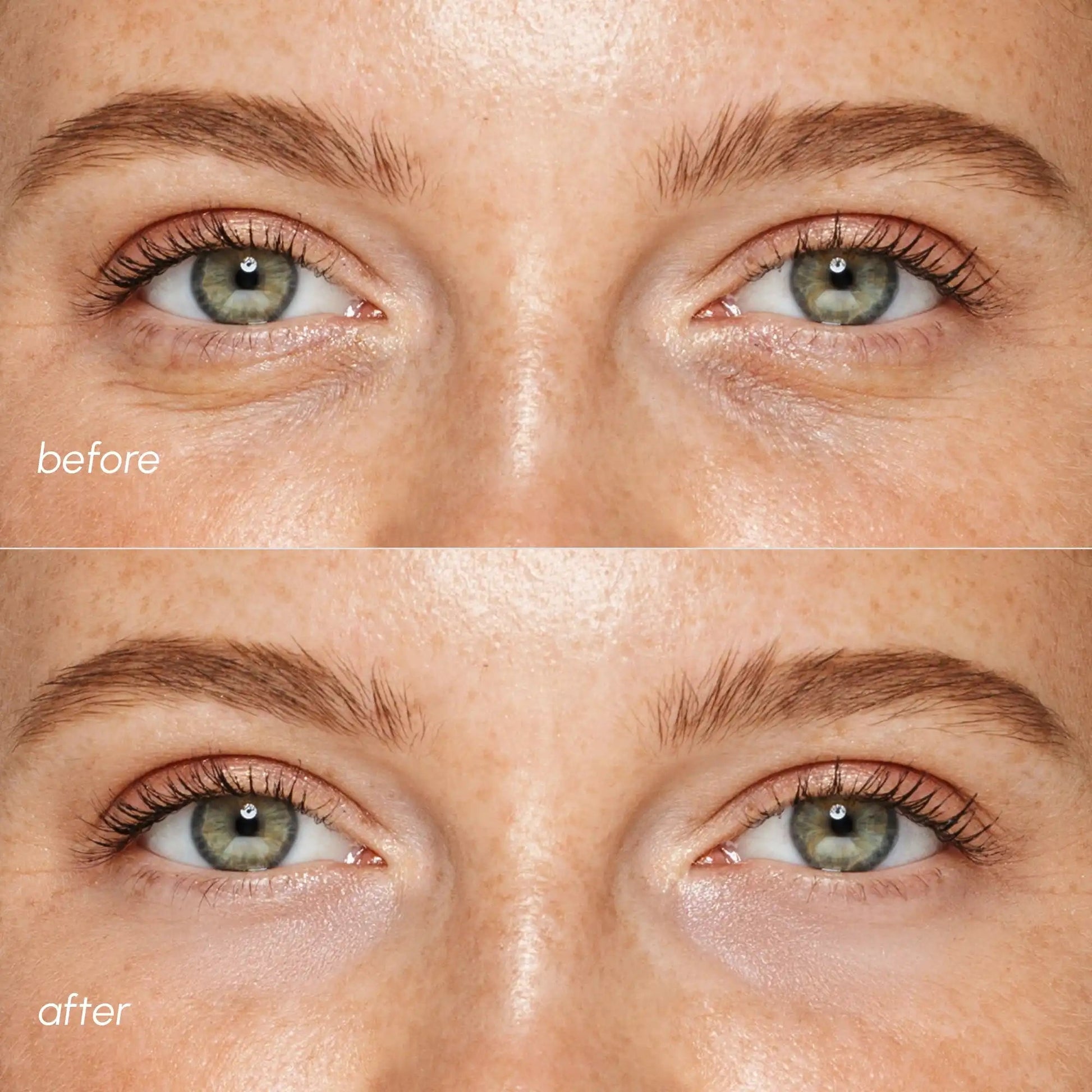 Pink Eye Patches for Puffy Eyes - Luvora